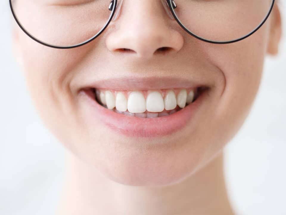 close up of a womans face that is smiling showing off her six tips for whiter teeth worthy smile