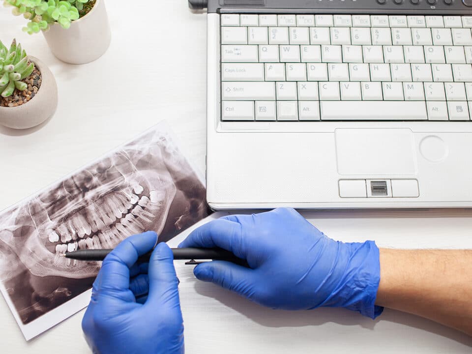 dentist examines an xray to decide if a patient's wisdom teeth need to be removed