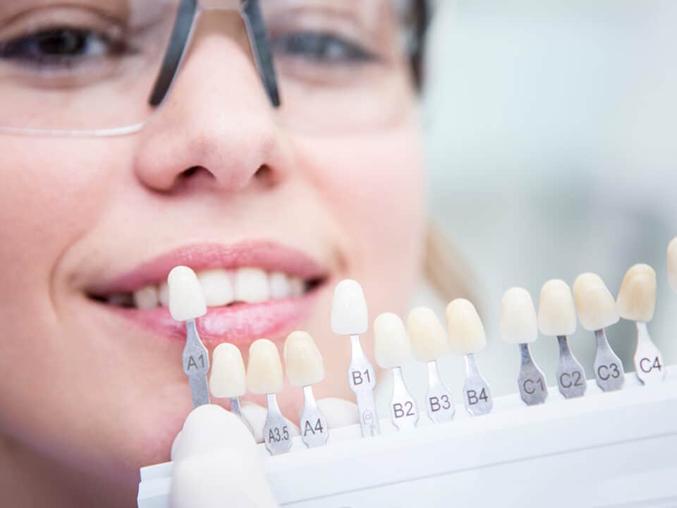 woman is choosing out the shade she'd like to reach after her professional teeth whitening