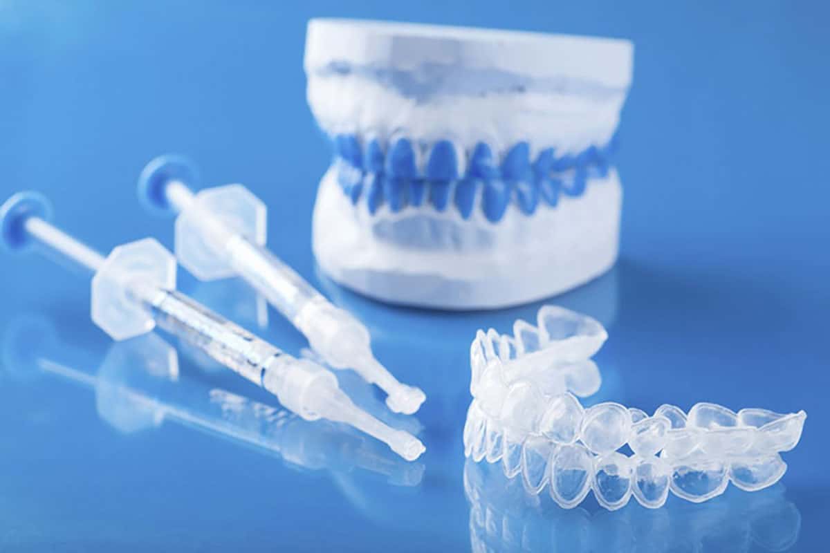 a photo of an over-the-counter-teeth whitening kit