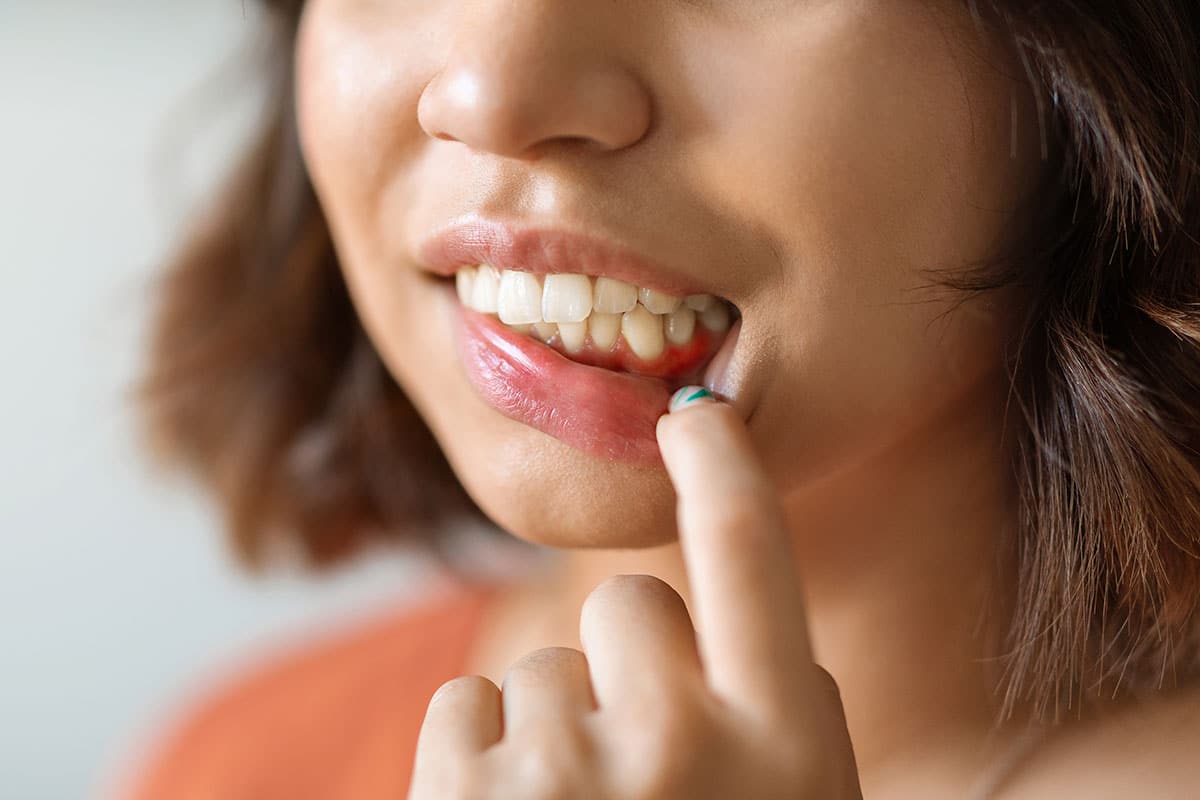 woman showing her gumline as she thinks about whether her flossing is good for her gums