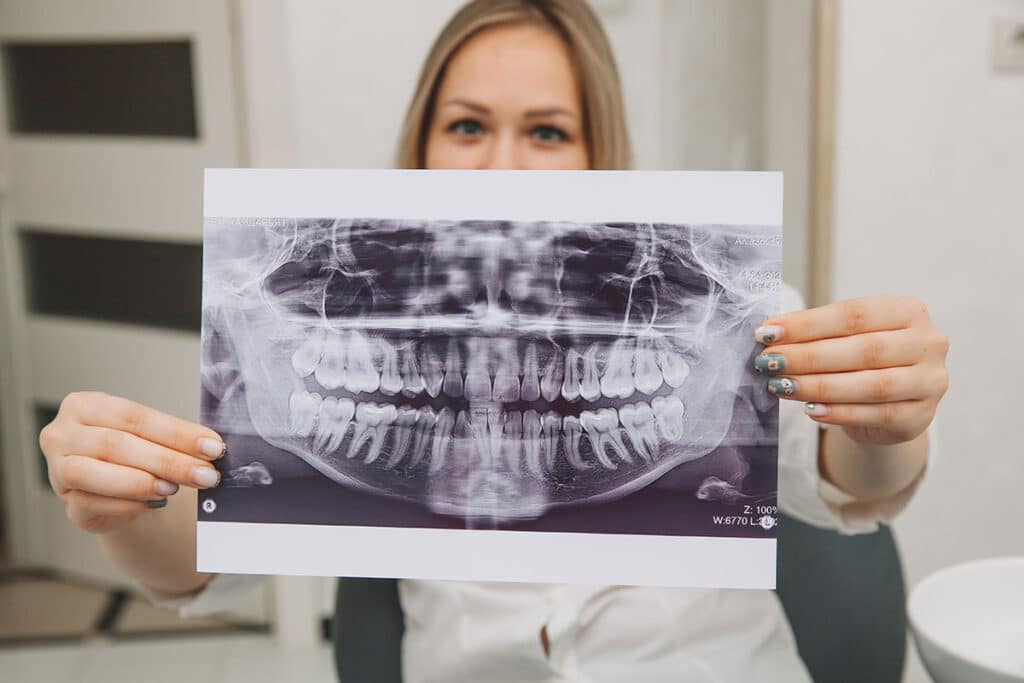 woman confidently holding up a large picture of her dental xray after she read through our patient’s guide to dental x-rays