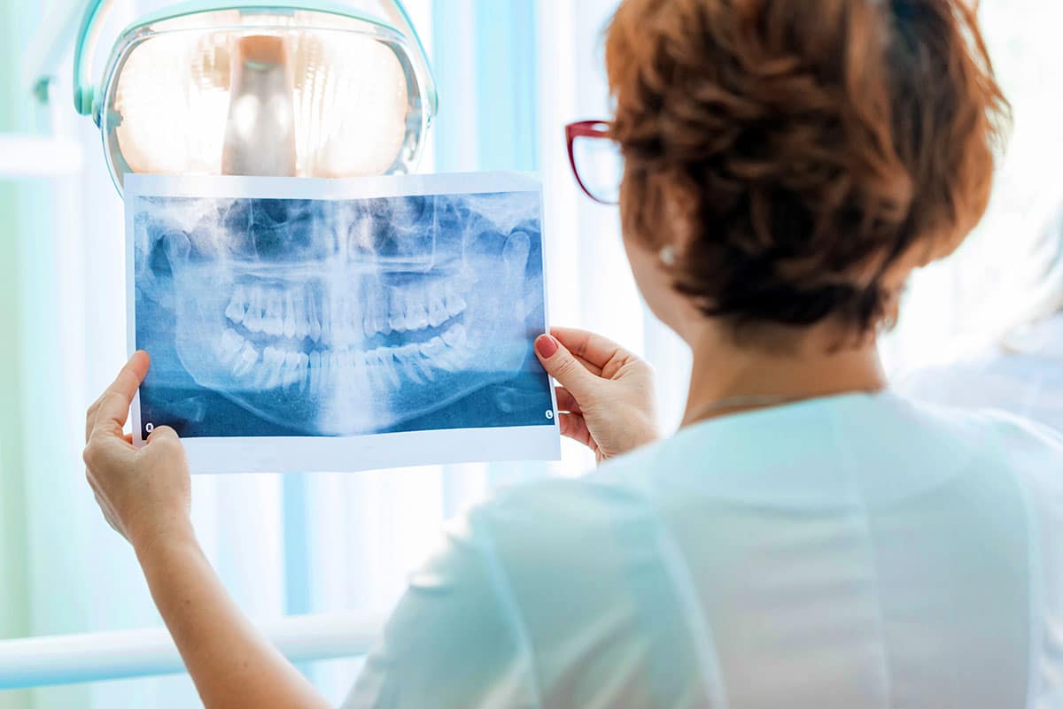 dentist examines a dental xray to determine if periodontal disease is present