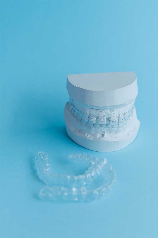 image of a dental mold with custom fit mouthguard lying beside it