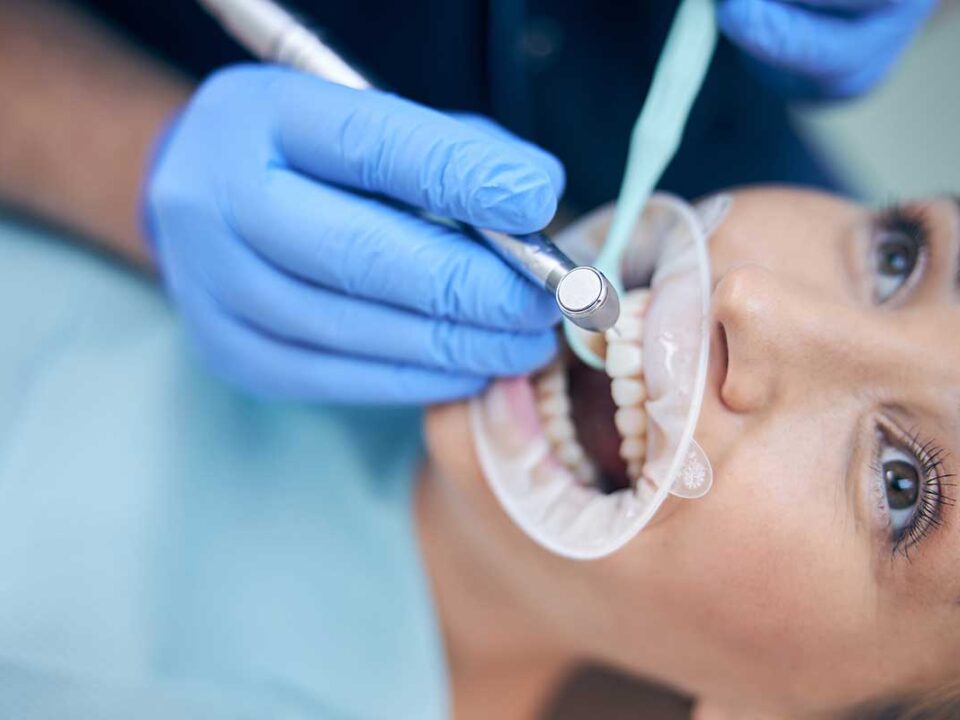 woman having a dental fillings installed to fix a cavity