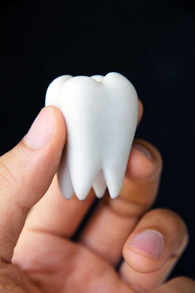 hand holds a model of a wisdom tooth