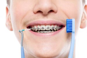 hero image for the ultimate guide to oral hygiene with braces showing a young man with braces, holding up a toothbrush and an interdental brush