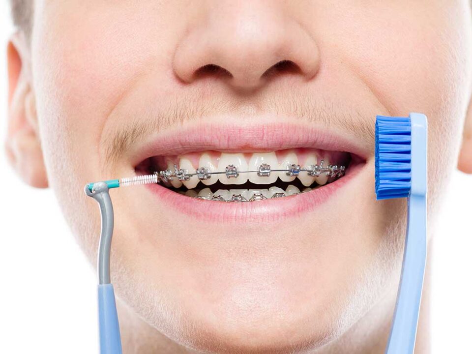hero image for the ultimate guide to oral hygiene with braces showing a young man with braces, holding up a toothbrush and an interdental brush