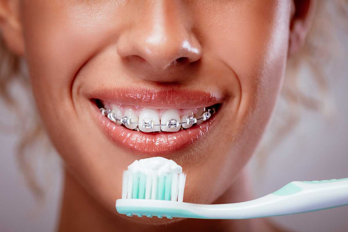 woman with braces holds a toothbrush filled with toothpaste