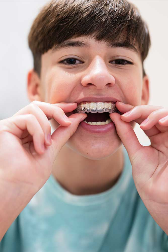 photo of a teenage boy removing his invisalign retainer