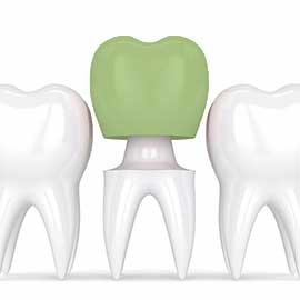 image of a green dental crown