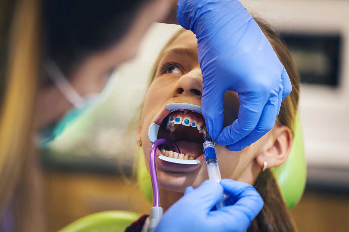 child getting fitted for braces at the orthodontist