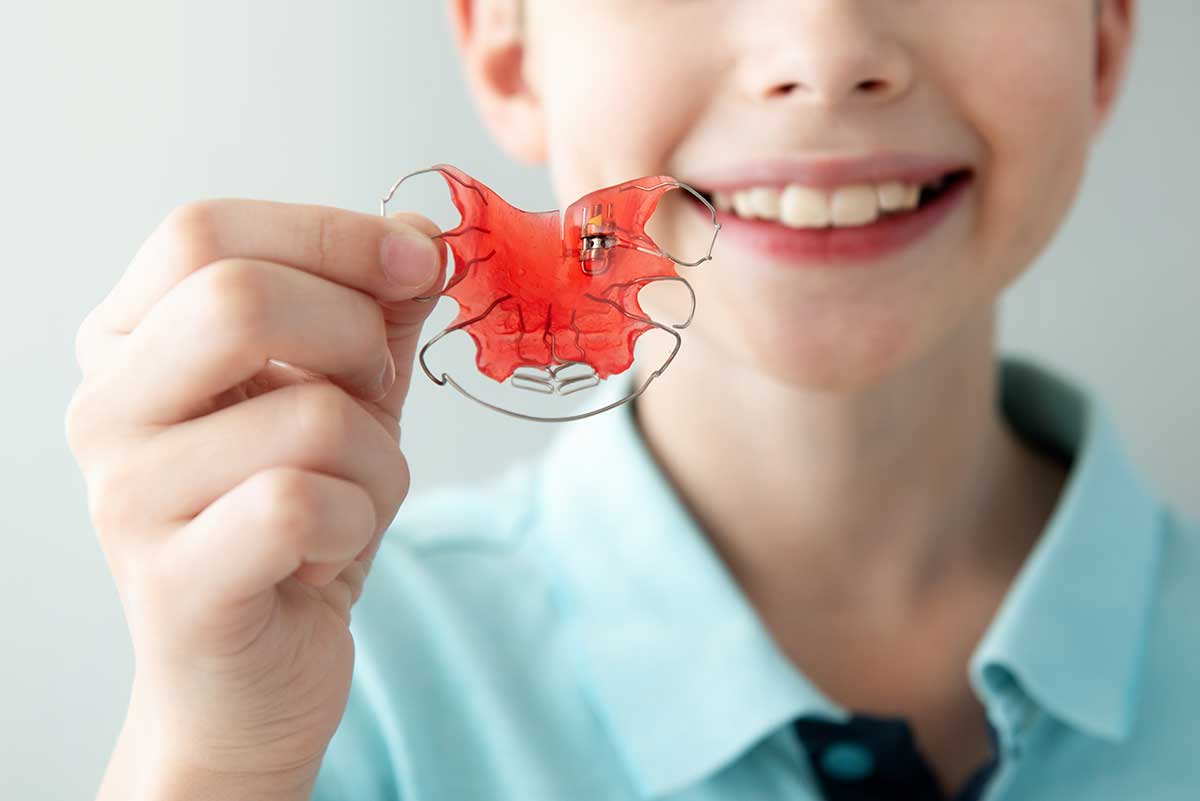 young girl shows off a red retainer as an alternative option to orthodontic braces