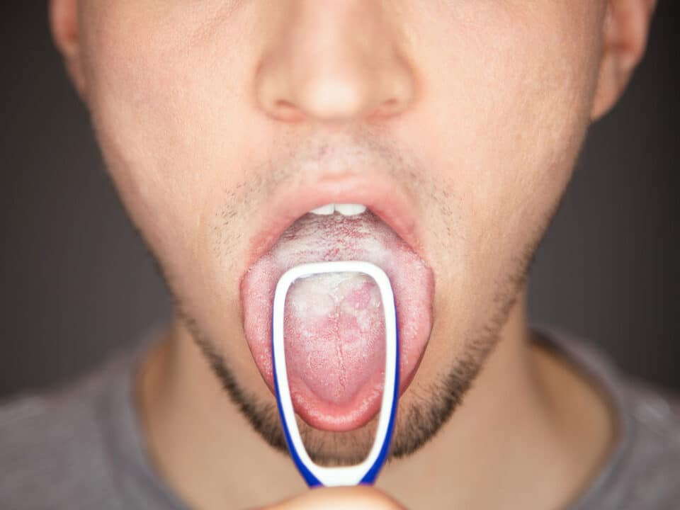 man shows his bacteria filled tongue with a tonqgue scraper as he wonders if Are Respiratory Conditions Connected To Your Gum Health