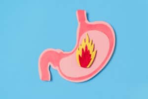the hero image for the how does acid reflux affect your teeth blog showing a cardboard paper cutout of a stomach with a flame inside signify acid reflux