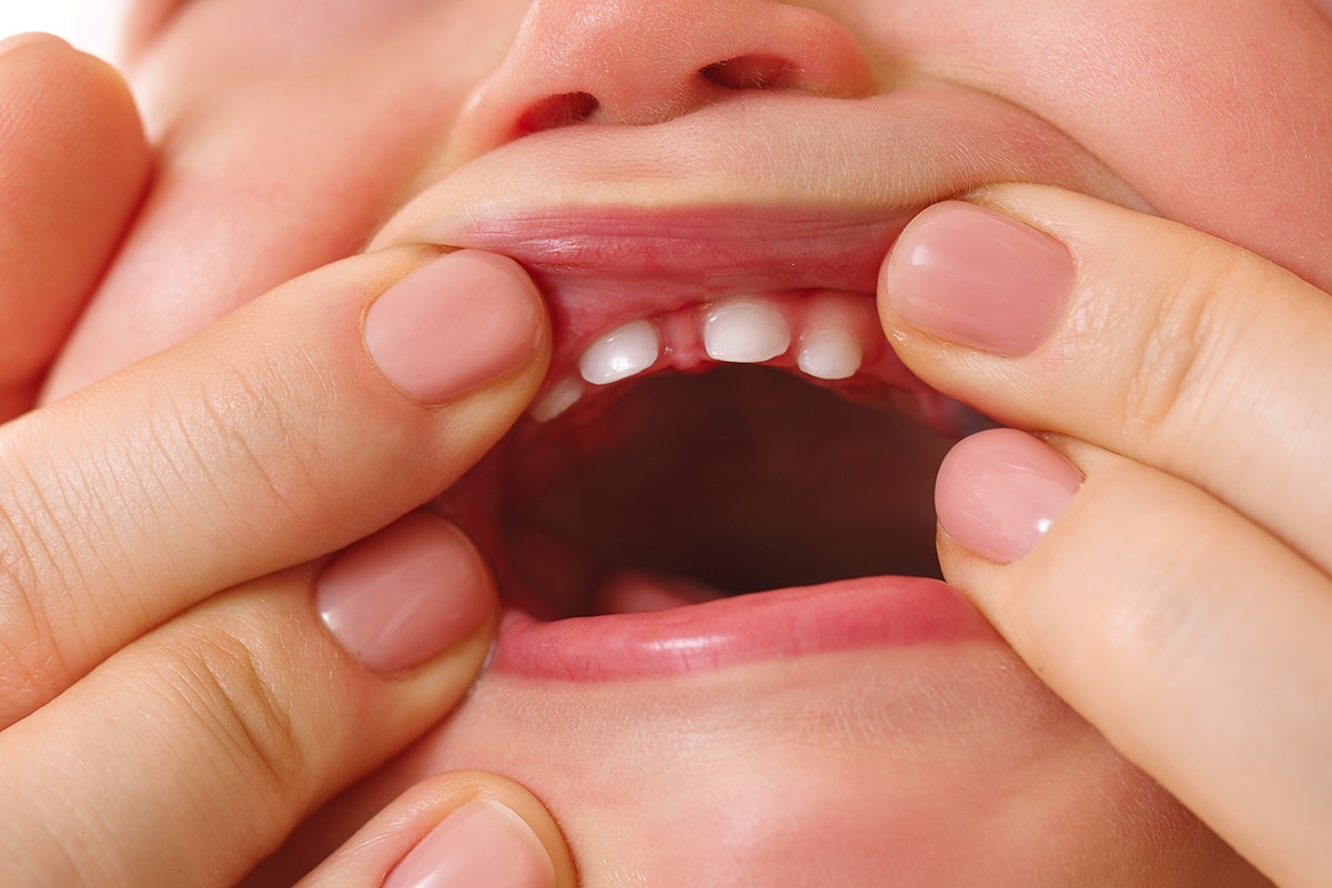 mother holds open her infants mouth to inspect tooth eruption to make sure that diet is good for dental milestones