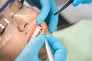 woman with safety glasses on is having her teeth deep cleaned b her dentist after reading up on deep dental cleanings vs regular cleanings and making the decision to go for it