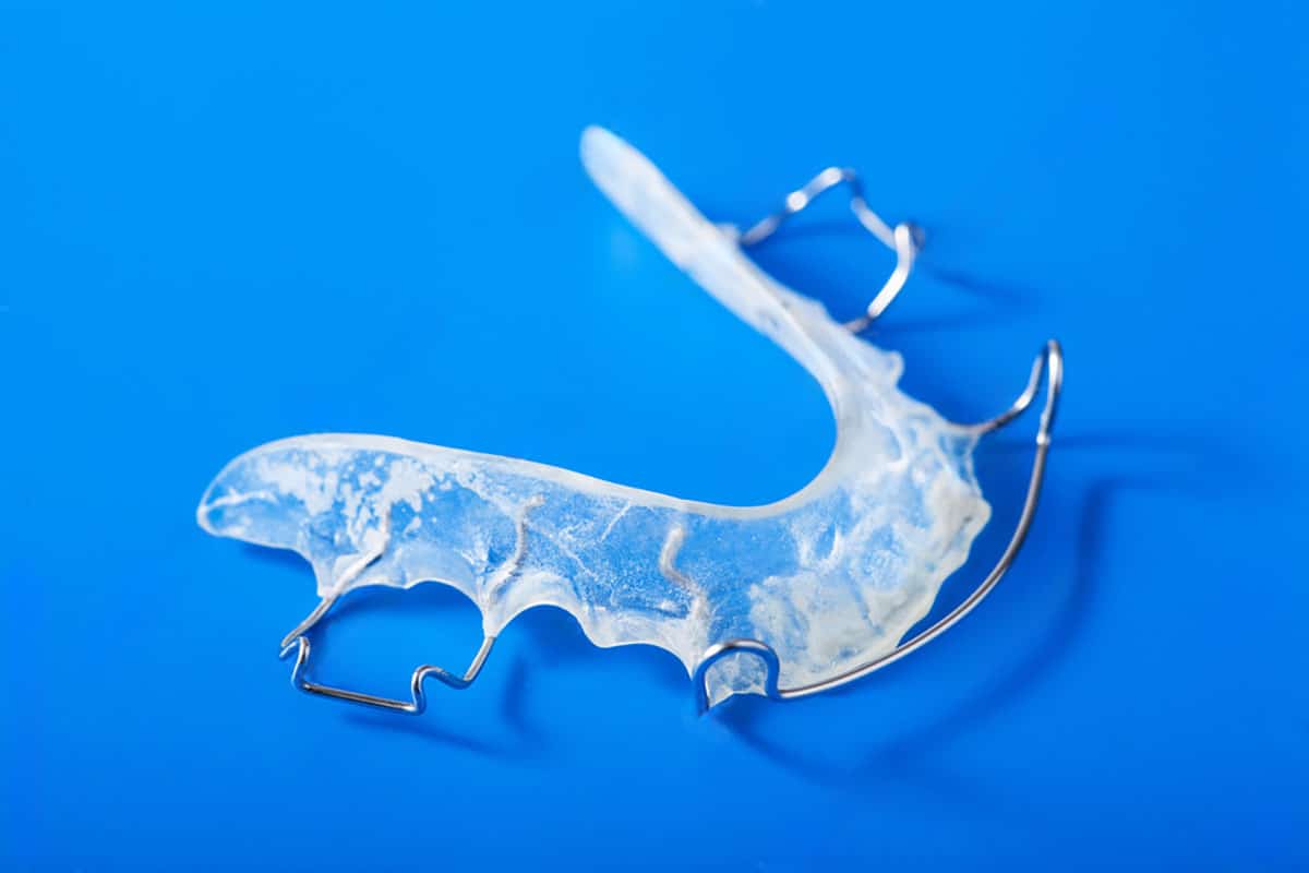 image of a retainer style or removeable space retainer