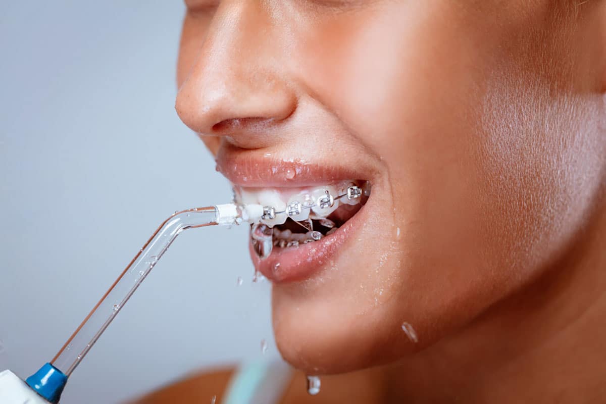 woman using a waterpik on her braces to clean them great effect.