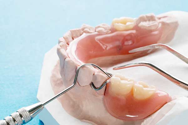 photo of some partial-dentures-being fitted to a patients mold