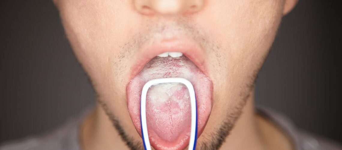 man shows his bacteria filled tongue with a tonqgue scraper as he wonders if Are Respiratory Conditions Connected To Your Gum Health