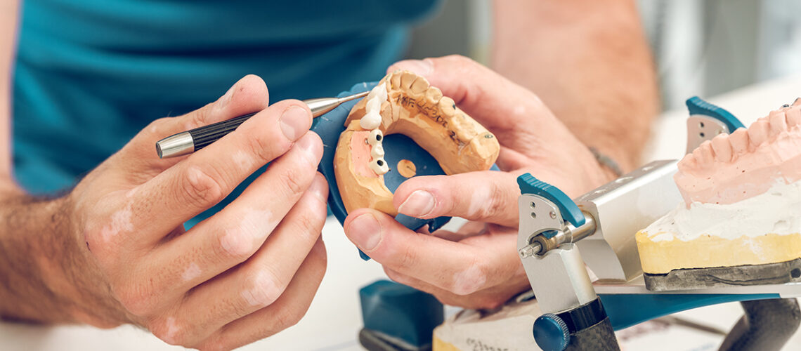 dental implant specialist adjusts the placement of a some dental implants