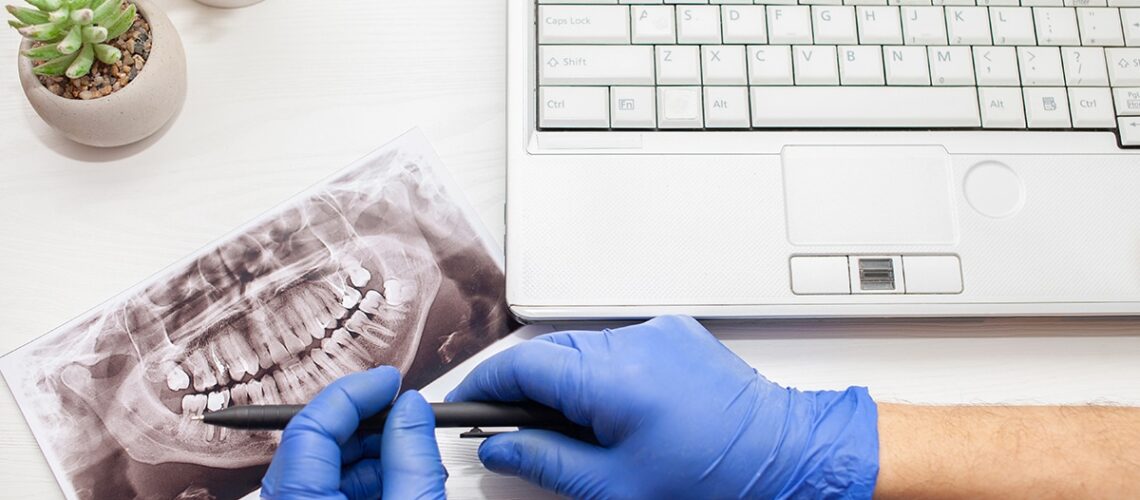 dentist examines an xray to decide if a patient's wisdom teeth need to be removed