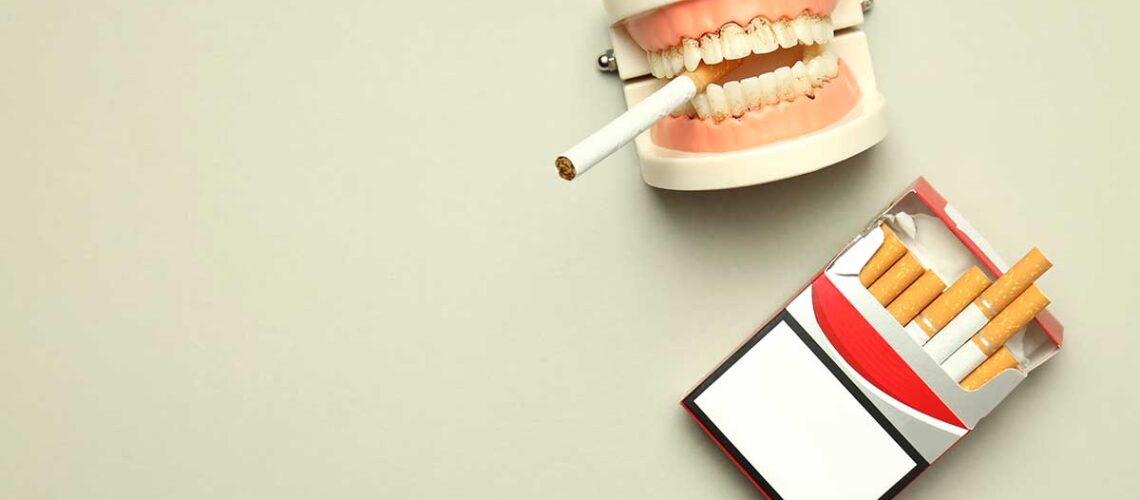 image of dentures with a cigarette dangling between the teeth as the featured image for our article on how to keep teeth white even if you smoke