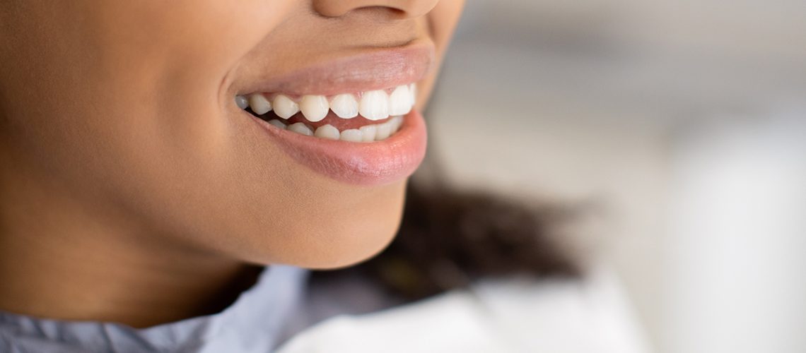 why-do-my-teeth-have-white-stains-after-whitening