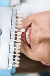 woman choosing hte right colour for her porcelain veneers in hamilton